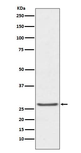 Anti-TIMP1 Rabbit Monoclonal Antibody Boster Bio