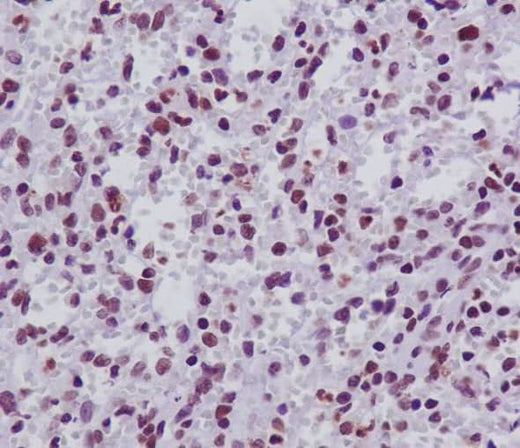 Anti-FANCD2 Rabbit Monoclonal Antibody Boster Bio