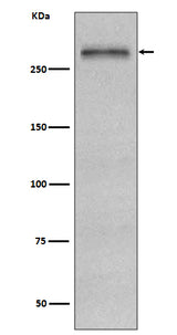 Anti-Fibronectin FN1 Rabbit Monoclonal Antibody Boster Bio
