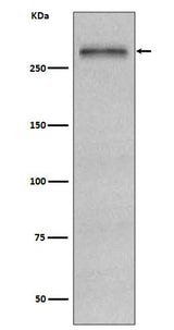 Anti-Fibronectin FN1 Rabbit Monoclonal Antibody Boster Bio