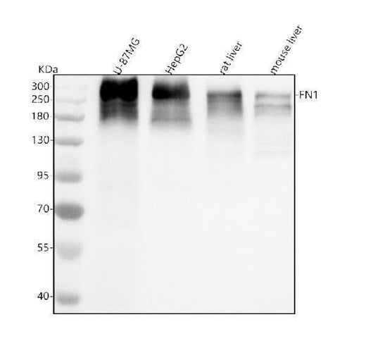 Anti-Fibronectin Rabbit Monoclonal Antibody Boster Bio