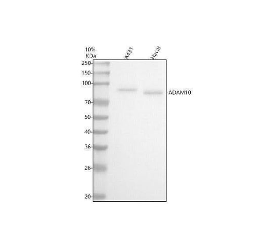 Anti-ADAM10 Rabbit Monoclonal Antibody Boster Bio
