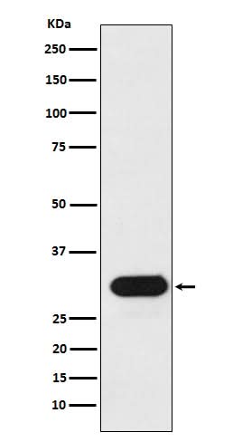 Anti-HLA-Drb1 Monoclonal Antibody Boster Bio