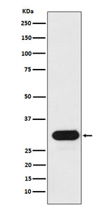 Anti-HLA-Drb1 Monoclonal Antibody Boster Bio