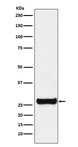 Anti-GSTM1 Rabbit Monoclonal Antibody Boster Bio