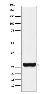 Anti-GSTM1 Rabbit Monoclonal Antibody Boster Bio