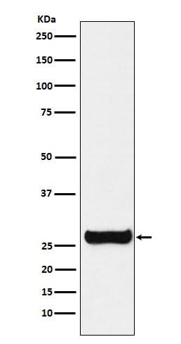 Anti-GSTM1 Rabbit Monoclonal Antibody Boster Bio