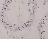 Anti-XRCC1 Rabbit Monoclonal Antibody Boster Bio