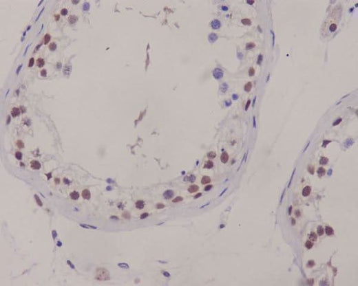 Anti-XRCC1 Rabbit Monoclonal Antibody Boster Bio