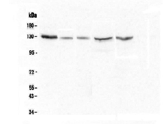 Anti-CASR Antibody Picoband® (monoclonal, 11E9 Boster Bio
