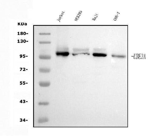 Anti-UBE3A Picoband® Antibody (monoclonal, 8I3 Boster Bio