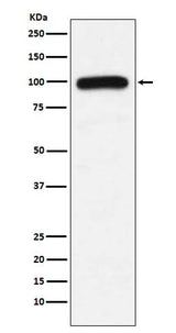 Anti-UBE3A Monoclonal Antibody Boster Bio