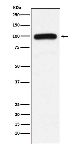 Anti-UBE3A Monoclonal Antibody Boster Bio