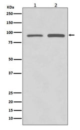 Anti-SUZ12 Rabbit Monoclonal Antibody Boster Bio