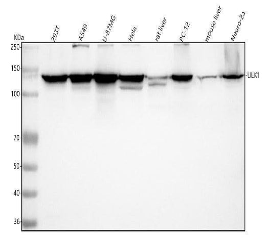 Anti-ULK1/Atg1 Rabbit Monoclonal Antibody Boster Bio