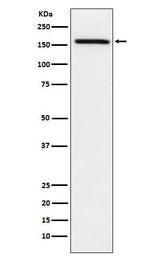 Anti-ADAMTS13 Rabbit Monoclonal Antibody Boster Bio