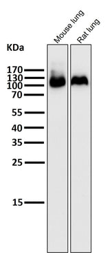Anti-Integrin beta 3 ITGB3 Rabbit Monoclonal Antibody Boster Bio