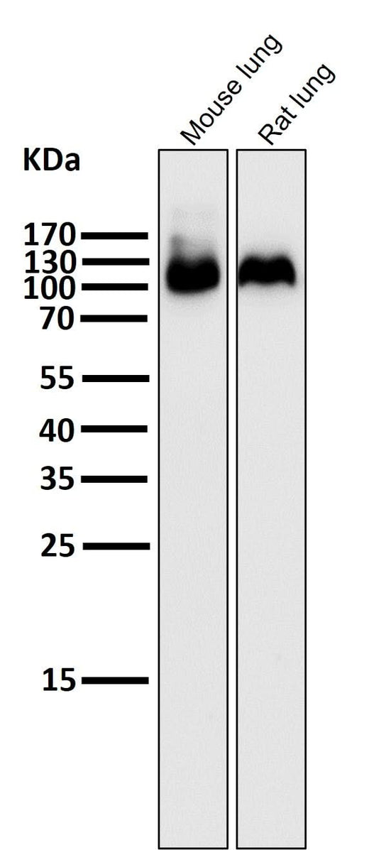 Anti-Integrin beta 3 ITGB3 Rabbit Monoclonal Antibody Boster Bio