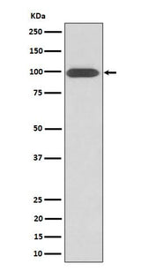 Anti-Integrin beta 3 / CD61 Rabbit Monoclonal Antibody Boster Bio