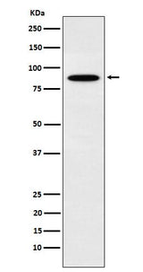 Anti-EWSR1 Rabbit Monoclonal Antibody Boster Bio