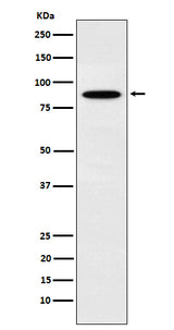 Anti-EWSR1 Rabbit Monoclonal Antibody Boster Bio