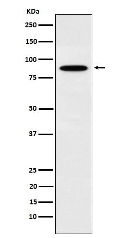 Anti-EWSR1 Rabbit Monoclonal Antibody Boster Bio