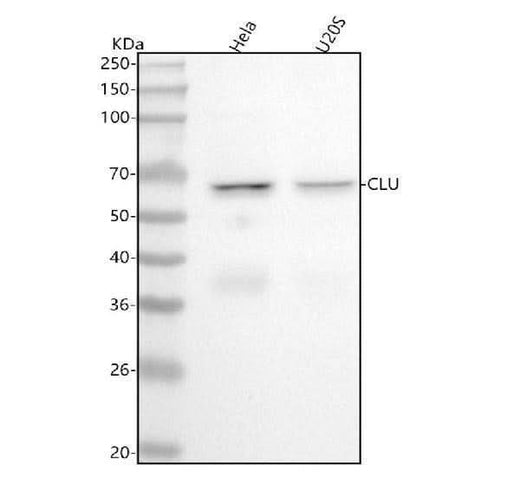 Anti-Clusterin Rabbit Monoclonal Antibody Boster Bio
