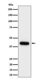 Anti-Clusterin Rabbit Monoclonal Antibody Boster Bio