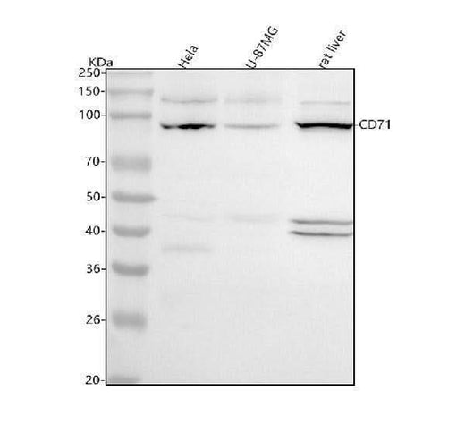 Anti-Transferrin Receptor (CD71) TFRC Rabbit Monoclonal Antibody Boster Bio