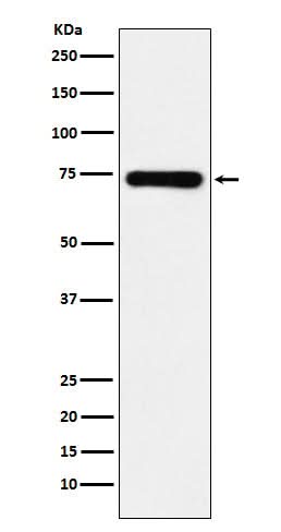Anti-SAMHD1 Monoclonal Antibody Boster Bio