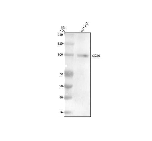 Anti-CD26/DPP4 Rabbit Monoclonal Antibody Boster Bio