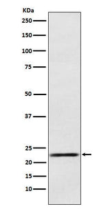 Anti-Prolactin Rabbit Monoclonal Antibody Boster Bio