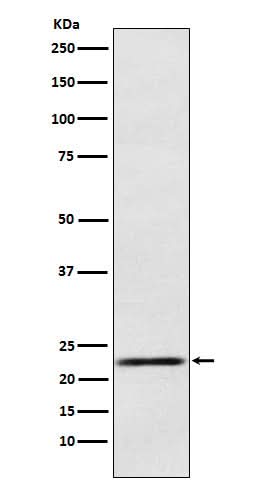 Anti-Prolactin Rabbit Monoclonal Antibody Boster Bio