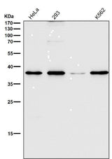 Anti-CD68/Sr D1 Rabbit Monoclonal Antibody Boster Bio