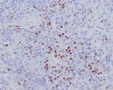 Anti-LEF1 Rabbit Monoclonal Antibody Boster Bio