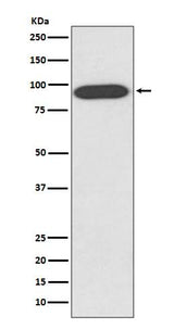 Anti-VCP Rabbit Monoclonal Antibody Boster Bio