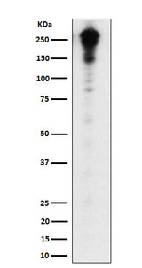 Anti-Desmoplakin Rabbit Monoclonal Antibody Boster Bio