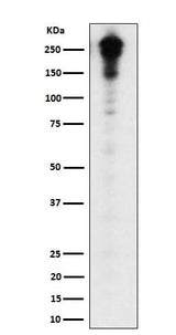 Anti-Desmoplakin Rabbit Monoclonal Antibody Boster Bio