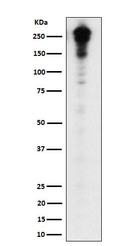 Anti-Desmoplakin Rabbit Monoclonal Antibody Boster Bio