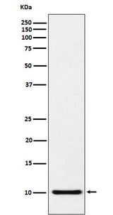 Anti-RANTES CCL5 Monoclonal Antibody Boster Bio