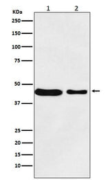 Anti-MC4 Receptor Rabbit Monoclonal Antibody Boster Bio