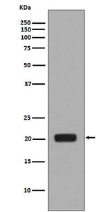 Anti-MCSF Rabbit Monoclonal Antibody Boster Bio