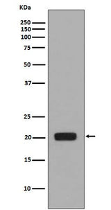 Anti-MCSF Rabbit Monoclonal Antibody Boster Bio