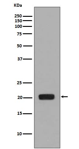 Anti-MCSF Rabbit Monoclonal Antibody Boster Bio