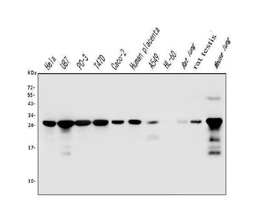 Anti-Galectin 3/LGALS3 Antibody Picoband® (monoclonal, 12B12 Boster Bio