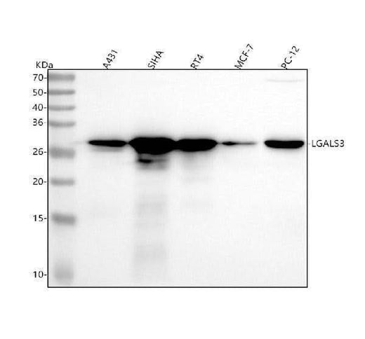 Anti-Galectin 3 Rabbit Monoclonal Antibody Boster Bio