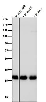 Anti-Galectin 3 LGALS3 Rabbit Monoclonal Antibody Boster Bio