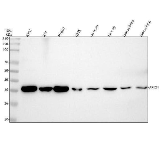 Anti-APE1 Rabbit Monoclonal Antibody Boster Bio