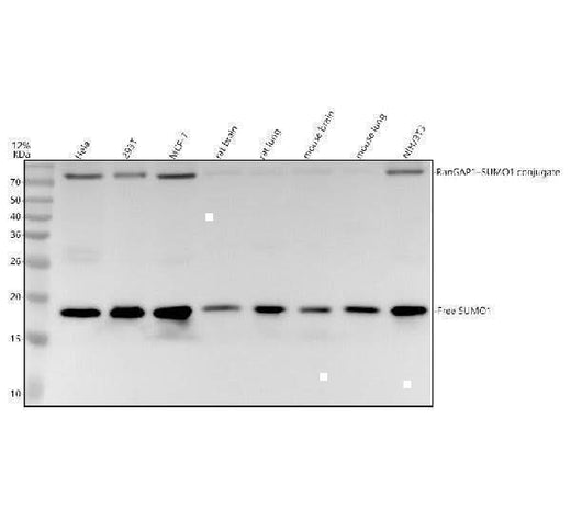Anti-Sumo 1 Rabbit Monoclonal Antibody Boster Bio