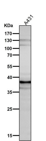 Anti-DKK1 Rabbit Monoclonal Antibody Boster Bio